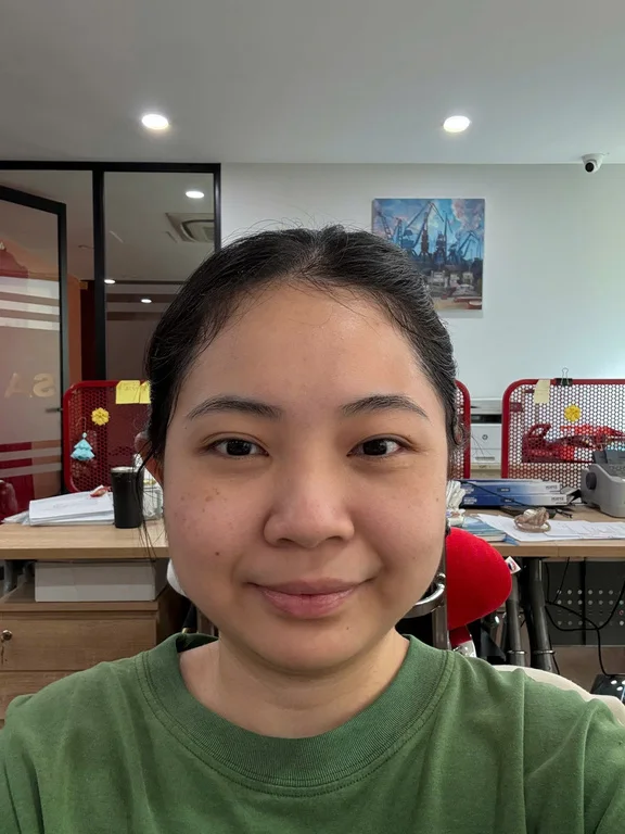 Before của HV Như Ý trong case học viên.